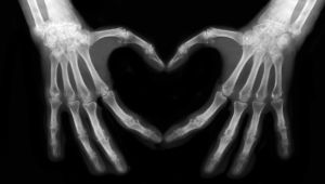 Bones of hands making the sign of love