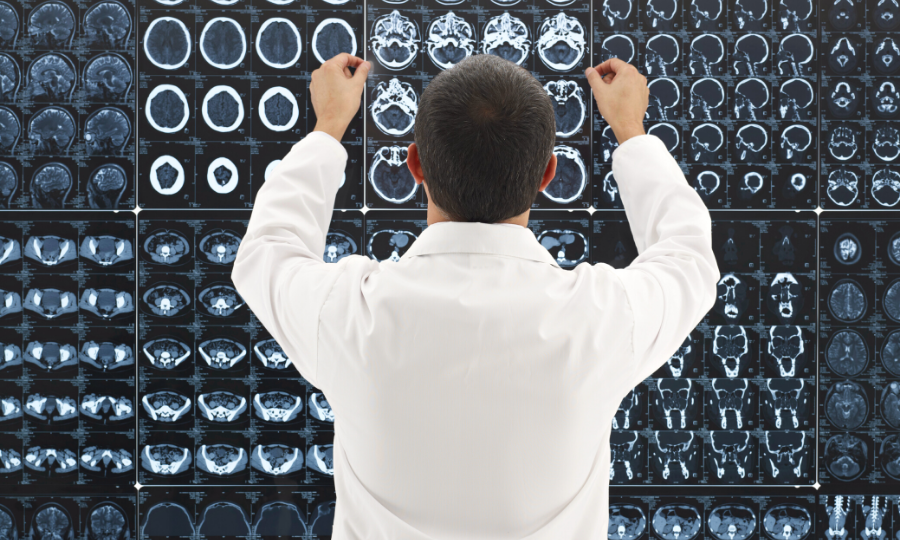 Male neurologists studies MRI brain scans