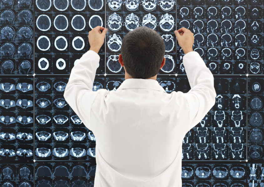 Male neurologists studies MRI brain scans